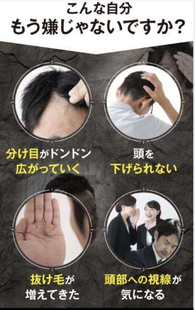 TVで絶賛放映!【HAIRMO】ヒト毛根細胞 順化培養液*5導入液&育毛剤&頭皮マッサージブラシ3点セット23,760円が < ヘルス/ビューティー  TVで絶賛放映!【HAIRMO】ヒト毛根細胞 順化培養液*5導入液&育毛剤&頭皮マッサージブラシ3点セット23,760円が < ヘルス/ビューティーの