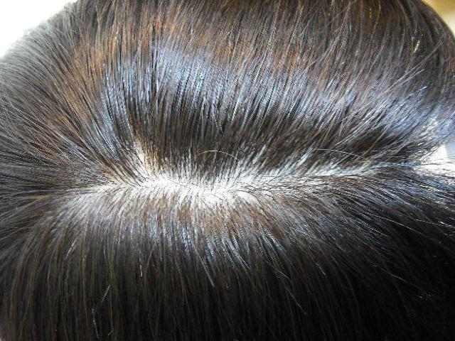 人毛 ウィッグ 幅広人工皮膚付き 自然色 ロング Mサイズ < 女性ファッション  人毛 ウィッグ 幅広人工皮膚付き 自然色 ロング Mサイズ < 女性ファッションの