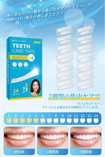 �z���C�g�j���O �� �V�[�g 14���� �e�[�v ���� �Z���t ������ �W���P�A ���΂� ���� ���� �ȒP 30�� �X�e�C�����Ƃ� �� �w���X/�r���[�e�B�[�� 