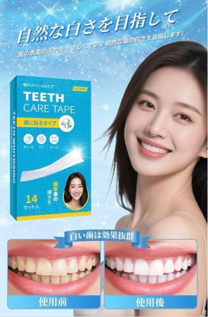 �z���C�g�j���O �� �V�[�g 14���� �e�[�v ���� �Z���t ������ �W���P�A ���΂� ���� ���� �ȒP 30�� �X�e�C�����Ƃ� �� �w���X/�r���[�e�B�[�� 