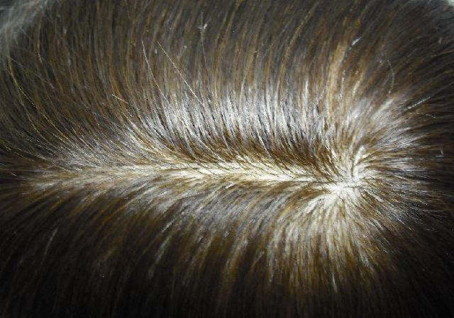 新商品 人毛 手植え 幅広人工皮膚付き ロング ブラウン < 女性ファッション  新商品 人毛 手植え 幅広人工皮膚付き ロング ブラウン < 女性ファッションの