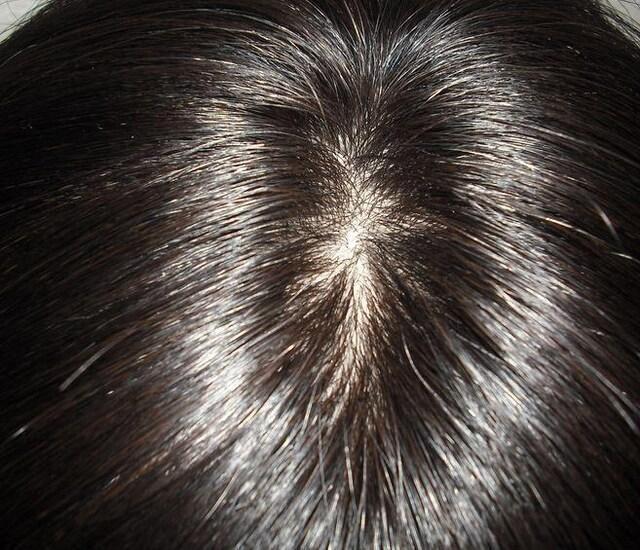 Vi@VNlbg TTo[WwA RFɋ߂_[NuE@MTCY@~fBAO  t@bV 