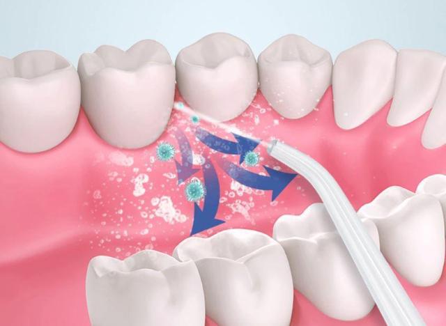 送料無料 未使用品 ピンク ウォーター フロス 口腔洗浄器 口腔洗浄機 ジェット ウォッシャー 220ML ノズル4個 100 < 家電/AV 送料無料 未使用品 ピンク ウォーター フロス 口腔洗浄器 口腔洗浄機 ジェット ウォッシャー 220ML ノズル4個 100 < 家電/AVの