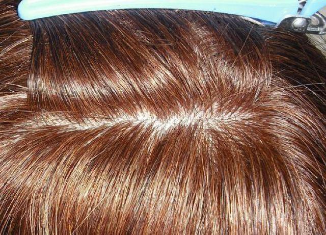 新品 人毛 ウィッグ 大き目人工皮膚付きロング Mサイズ < 女性ファッション  新品 人毛 ウィッグ 大き目人工皮膚付きロング Mサイズ < 女性ファッションの