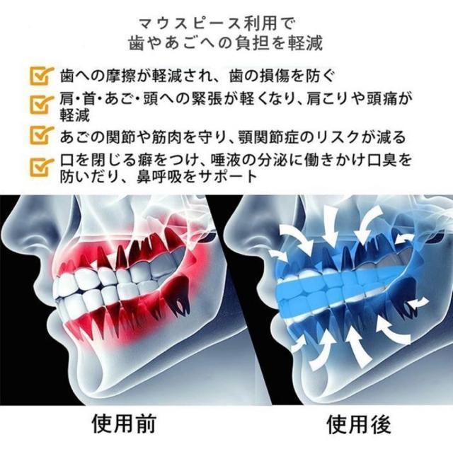 2個セット!ナイトガード マウスピース【新品未使用】 < ヘルス/ビューティー  2個セット!ナイトガード マウスピース【新品未使用】 < ヘルス/ビューティーの