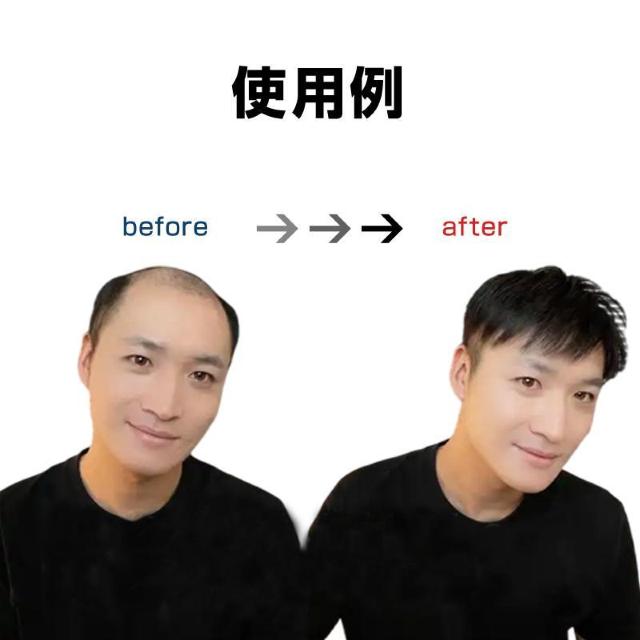 ウィッグ メンズ 男性 ヘアピース 人毛100% 頭頂部 部分ウィッグ トップカバー 薄毛 白髪隠し 増毛 ボリュームアップ 自然 < インテリア/ライフ  ウィッグ メンズ 男性 ヘアピース 人毛100% 頭頂部 部分ウィッグ トップカバー 薄毛 白髪隠し 増毛 ボリュームアップ 自然 < インテリア/ライフの