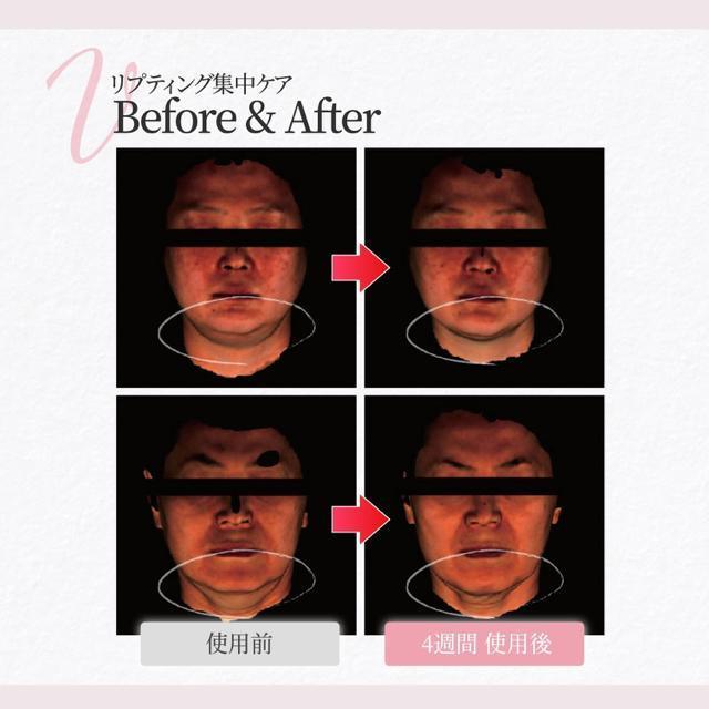 tgAbvyViz2聜VAbvpb`teBOAbv }XN  /RX/lC 