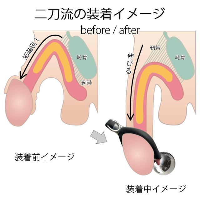 ペニス 牽引 包茎 矯正 リング クマッキー二刀流 サイズ調整型 陰茎 増大 器具 仮性 ほうけい グッズ ストラップ付 コック < ヘルス/ビューティー  ペニス 牽引 包茎 矯正 リング クマッキー二刀流 サイズ調整型 陰茎 増大 器具 仮性 ほうけい グッズ ストラップ付 コック < ヘルス/ビューティーの
