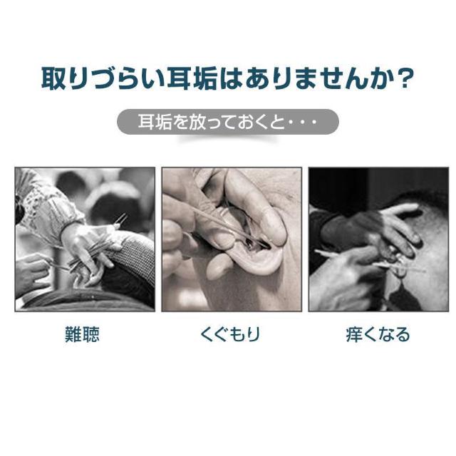 耳かき ツール 5本セット ピンセット 耳垢 掃除 除去 ステンレススチール 水洗い スッキリ ごっそり 汚れ 根こそぎ 安全 < ヘルス/ビューティー 耳かき ツール 5本セット ピンセット 耳垢 掃除 除去 ステンレススチール 水洗い スッキリ ごっそり 汚れ 根こそぎ 安全 < ヘルス/ビューティーの