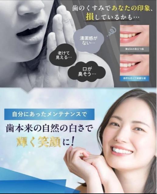 yVigpzzCgjO V[g 2814Zbg LVg[ cc ZtzCgjO  wX/r[eB[ 