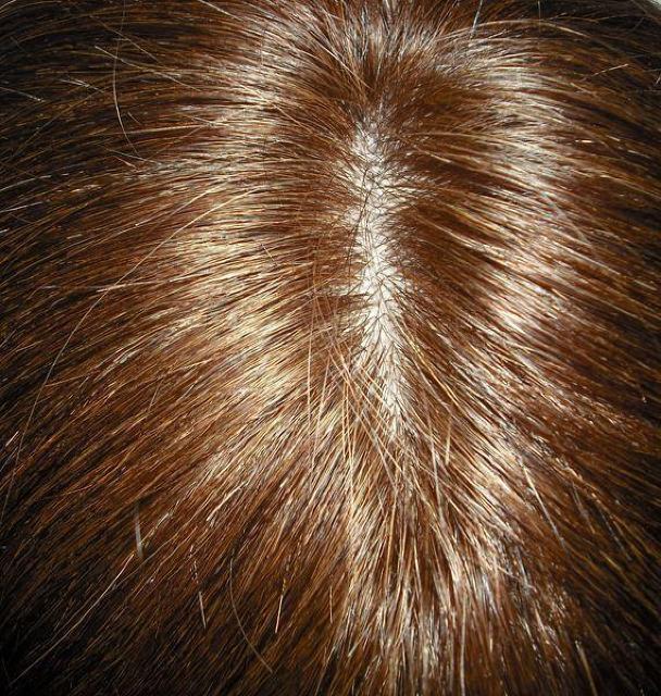 �l�� ���ɋ����@�����J�o�[�@�傫�ڃT�C�Y�@�@�����O�@��������߃u���E�� �� �����t�@�b�V������ 