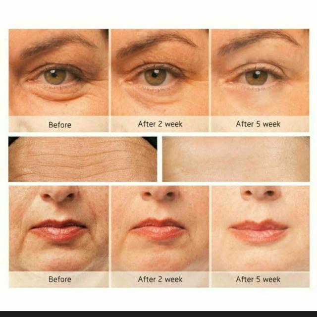 新品 未使用 電動 マッサージ 金 ローラー マシーン 美顔器 シワ シワ  < 家電/AV  新品 未使用 電動 マッサージ 金 ローラー マシーン 美顔器 シワ シワ  < 家電/AVの