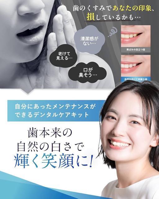 r[zCg NAV[g zCgjO V[g 2814Zbg  wX/r[eB[ 