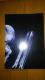 BEATLESS&_[ECEUEtLX@ʃ|X^[