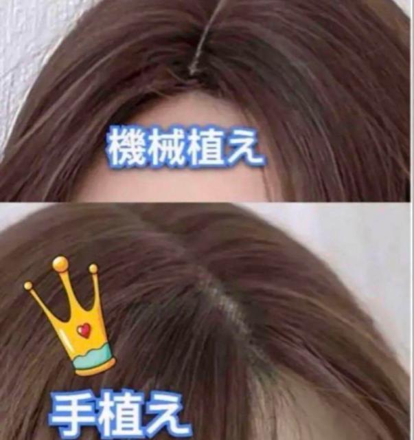 VigpA[XAtEBbOOXg[g_[NuE  t@bV 